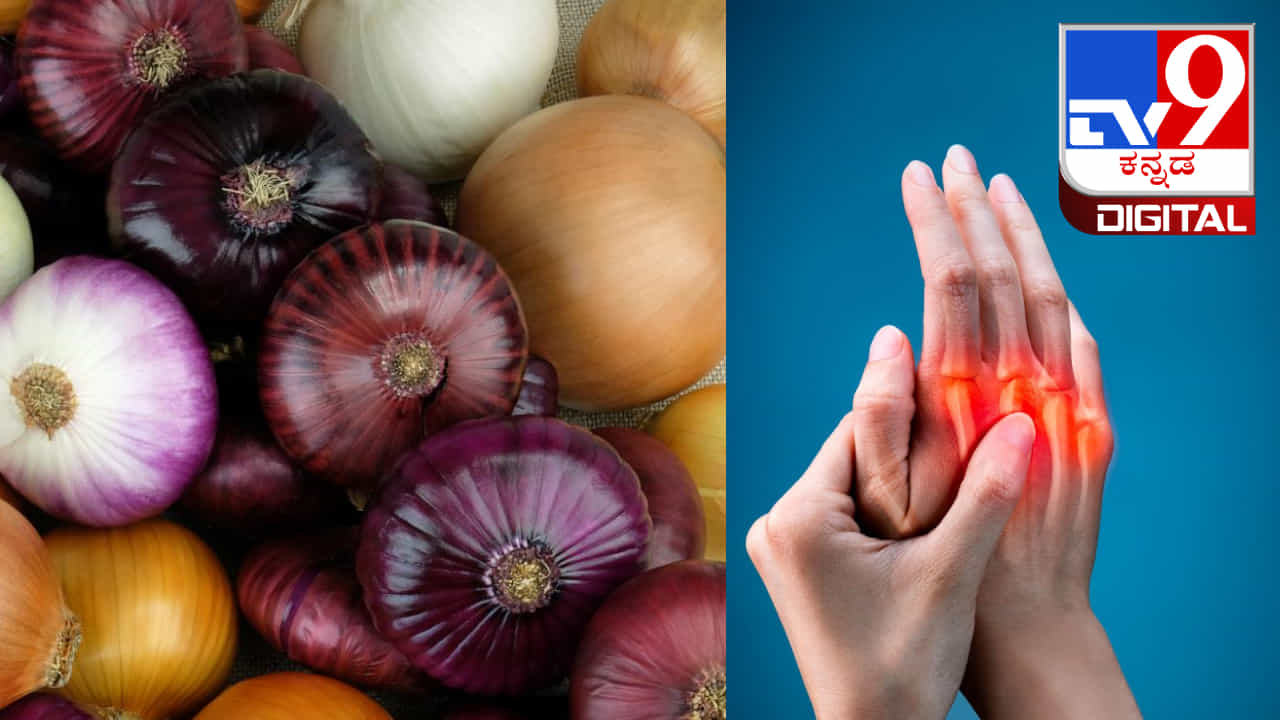 Benefits of Onions: ಸಂಧಿವಾತ ಸಮಸ್ಯೆಗೆ ಈರುಳ್ಳಿಯ ಪ್ರಯೋಜನಗಳು Benefits of Onions: ಸಂಧಿವಾತ ಸಮಸ್ಯೆಗೆ ಈರುಳ್ಳಿಯ ಪ್ರಯೋಜನಗಳು
