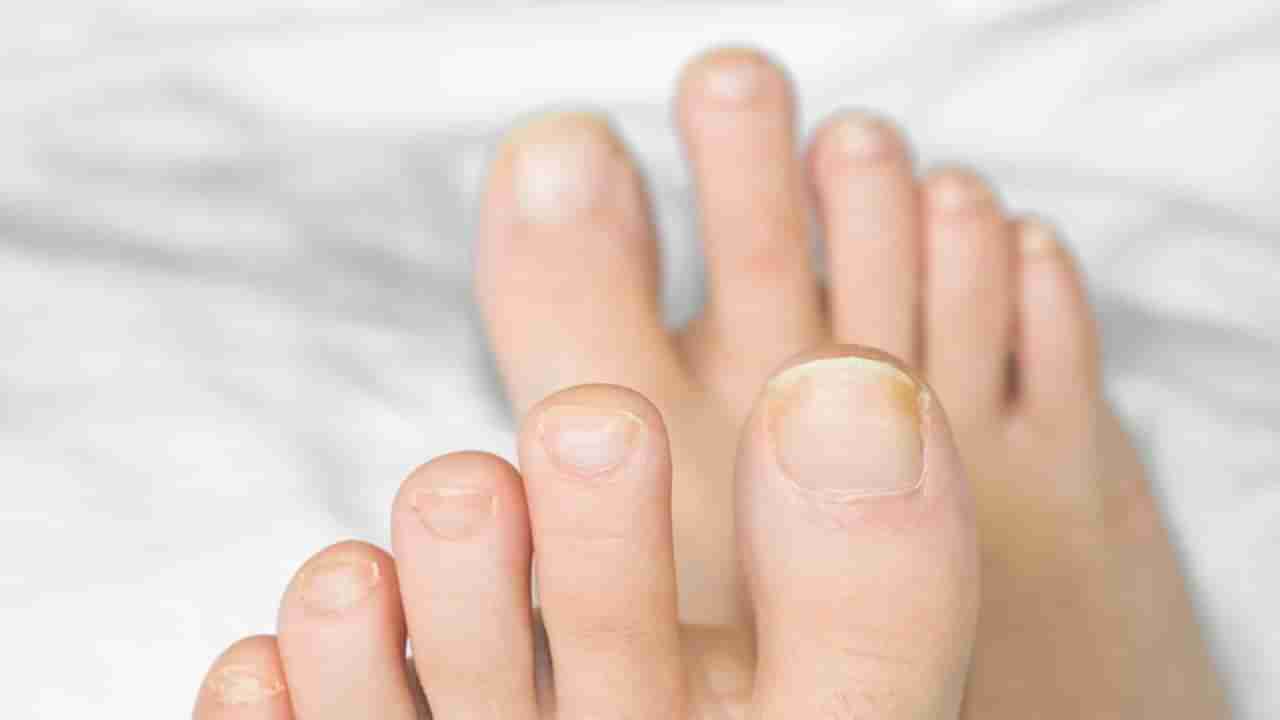 Look at your toenails: ನಿಮ್ಮ ಕಾಲ್ಬೆರಳಿನ ಉಗುರಿನ ಬಣ್ಣದ ಆಧಾರದ ಮೇಲೆ ನಿಮ್ಮ ಆರೋಗ್ಯ ನಿರ್ಧಾರ ಮಾಡಬಹುದು? ಅದು ಹೇಗೆ?