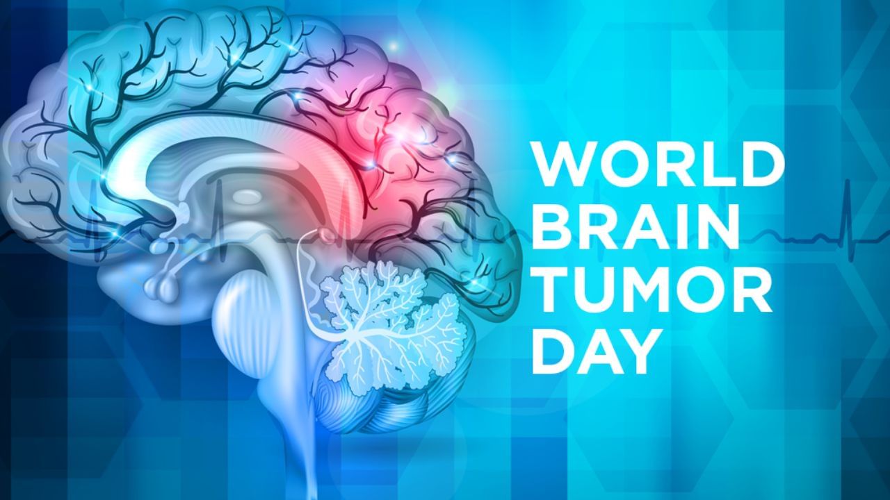 World Brain Tumor Day 2023: ಬ್ರೈನ್‌ ಟ್ಯೂಮರ್​ಗೆ ಕಾರಣವೇನು? ಇದರ ಲಕ್ಷಣಗಳು? ಇಲ್ಲಿದೆ ಮಾಹಿತಿ