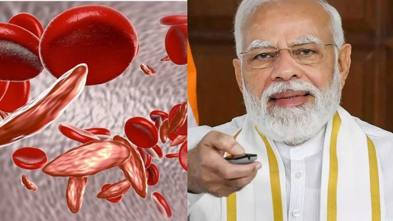 National Sickle Cell Anemia Elimination Program: 2047ರ ವೇಳೆಗೆ ಸಿಕಲ್‌ ಸೆಲ್‌ ಅನೀಮಿಯಾ ಮುಕ್ತವಾಗಬೇಕು ಭಾರತ, ಪ್ರಧಾನಿ ಮೋದಿ ಇಂದು ಆರೋಗ್ಯ ಮಿಷನ್​​ಗೆ ಚಾಲನೆ