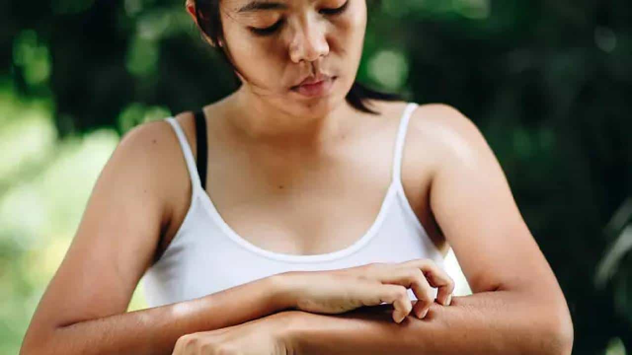 Dry Skin Home Remedies: ಒಣ ಚರ್ಮಕ್ಕಾಗಿ ಪರಿಣಾಮಕಾರಿ ಮನೆಮದ್ದುಗಳು Dry Skin Home Remedies: ಒಣ ಚರ್ಮಕ್ಕಾಗಿ ಪರಿಣಾಮಕಾರಿ ಮನೆಮದ್ದುಗಳು