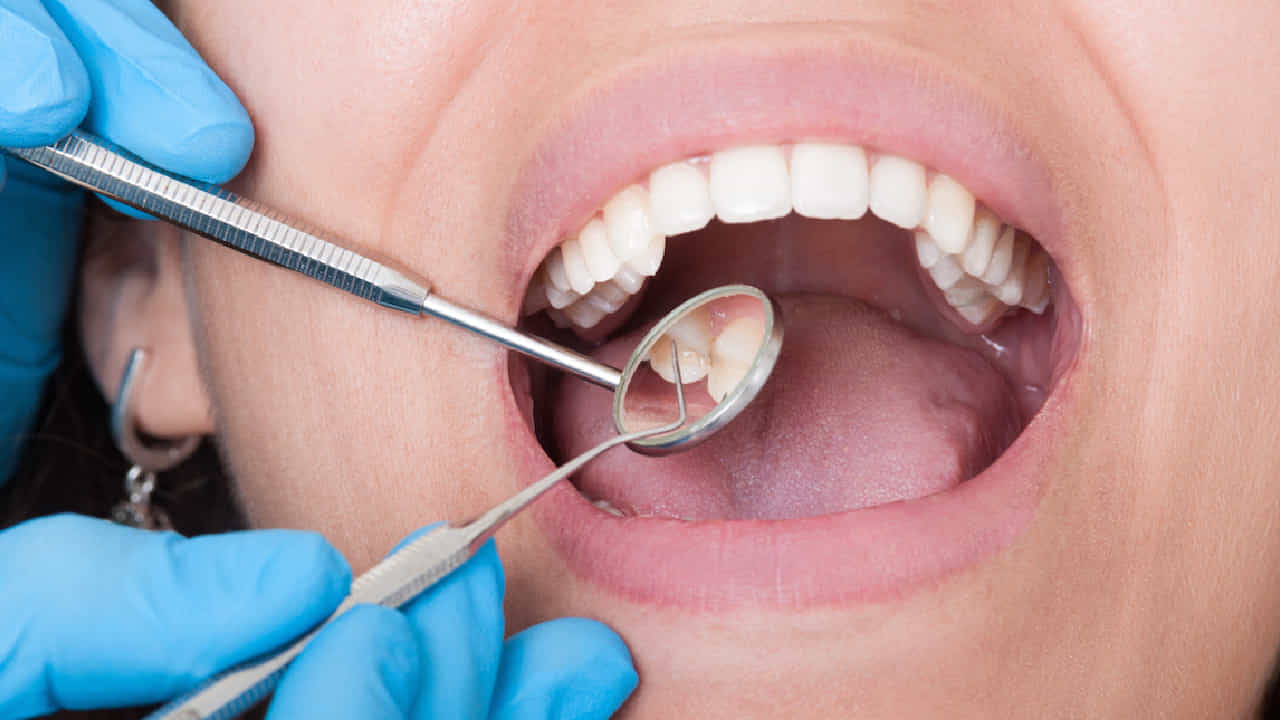 Oral Health: ಬಾಯಿ ಮತ್ತು ಹಲ್ಲುಗಳಲ್ಲಿ ಇಂತಹ ಲಕ್ಷಣಗಳು ಕಂಡುಬಂದರೆ ನಿರ್ಲಕ್ಷ್ಯಬೇಡ Oral Health: ಬಾಯಿ ಮತ್ತು ಹಲ್ಲುಗಳಲ್ಲಿ ಇಂತಹ ಲಕ್ಷಣಗಳು ಕಂಡುಬಂದರೆ ನಿರ್ಲಕ್ಷ್ಯಬೇಡ