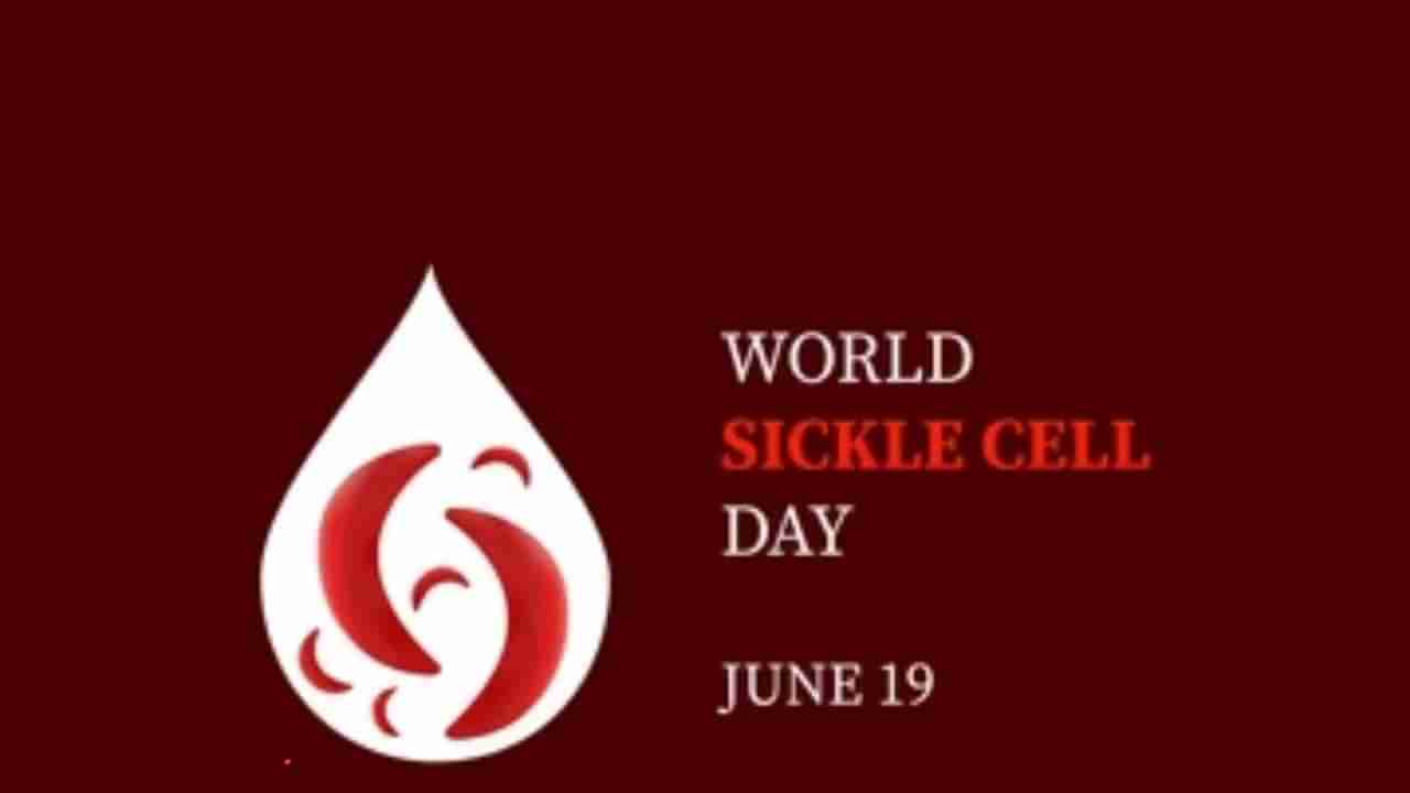 World Sickle Cell Awareness Day 2023: ವರ್ಲ್ಡ್ ಸಿಕಲ್ ಸೆಲ್ ಜಾಗೃತಿ ದಿನ ಇತಿಹಾಸ, ಮಹತ್ವ ಮತ್ತು ಆಚರಣೆ ಬಗ್ಗೆ ಇಲ್ಲಿದೆ ಮಾಹಿತಿ