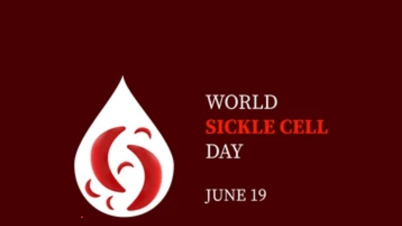 World Sickle Cell Awareness Day 2023: ವರ್ಲ್ಡ್ ಸಿಕಲ್ ಸೆಲ್ ಜಾಗೃತಿ ದಿನ ಇತಿಹಾಸ, ಮಹತ್ವ ಮತ್ತು ಆಚರಣೆ ಬಗ್ಗೆ ಇಲ್ಲಿದೆ ಮಾಹಿತಿ World Sickle Cell Awareness Day 2023: ವರ್ಲ್ಡ್ ಸಿಕಲ್ ಸೆಲ್ ಜಾಗೃತಿ ದಿನ ಇತಿಹಾಸ, ಮಹತ್ವ ಮತ್ತು ಆಚರಣೆ ಬಗ್ಗೆ ಇಲ್ಲಿದೆ ಮಾಹಿತಿ