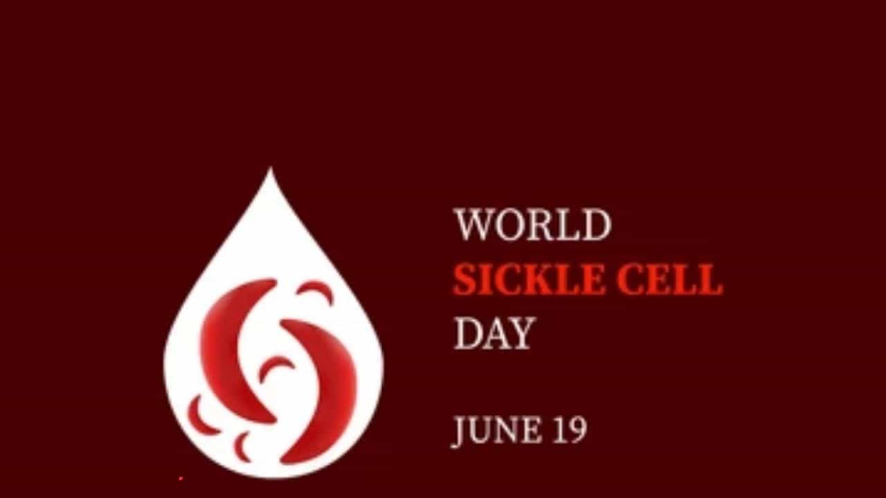 World Sickle Cell Awareness Day 2023: ವರ್ಲ್ಡ್ ಸಿಕಲ್ ಸೆಲ್ ಜಾಗೃತಿ ದಿನ ಇತಿಹಾಸ, ಮಹತ್ವ ಮತ್ತು ಆಚರಣೆ ಬಗ್ಗೆ ಇಲ್ಲಿದೆ ಮಾಹಿತಿ World Sickle Cell Awareness Day 2023: ವರ್ಲ್ಡ್ ಸಿಕಲ್ ಸೆಲ್ ಜಾಗೃತಿ ದಿನ ಇತಿಹಾಸ, ಮಹತ್ವ ಮತ್ತು ಆಚರಣೆ ಬಗ್ಗೆ ಇಲ್ಲಿದೆ ಮಾಹಿತಿ