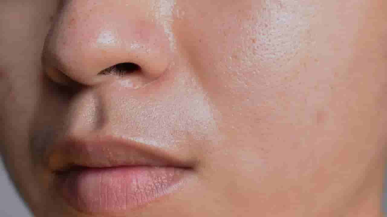 Skincare: ಎಣ್ಣೆಯುಕ್ತ ಚರ್ಮವನ್ನು ನಿರ್ವಹಿಸಲು ಪರಿಣಾಮಕಾರಿ ಸಲಹೆಗಳು