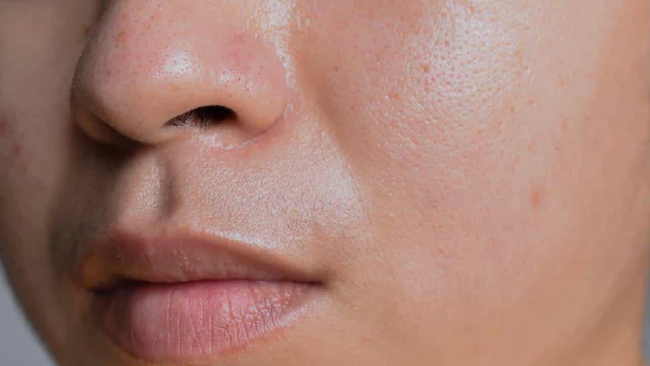 Skincare: ಎಣ್ಣೆಯುಕ್ತ ಚರ್ಮವನ್ನು ನಿರ್ವಹಿಸಲು ಪರಿಣಾಮಕಾರಿ ಸಲಹೆಗಳು Skincare: ಎಣ್ಣೆಯುಕ್ತ ಚರ್ಮವನ್ನು ನಿರ್ವಹಿಸಲು ಪರಿಣಾಮಕಾರಿ ಸಲಹೆಗಳು