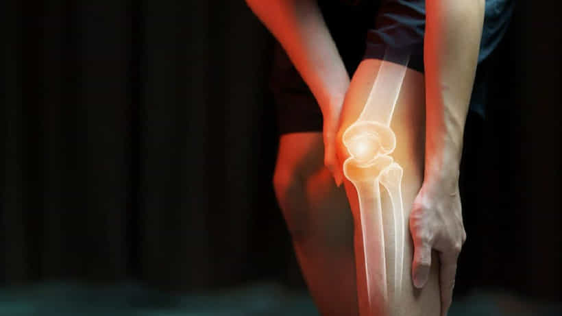 Bone Cancer: ಮೂಳೆ ಕ್ಯಾನ್ಸರ್ನ ಆರಂಭಿಕ ಲಕ್ಷಣಗಳನ್ನು ತಿಳಿದುಕೊಳ್ಳಿ
