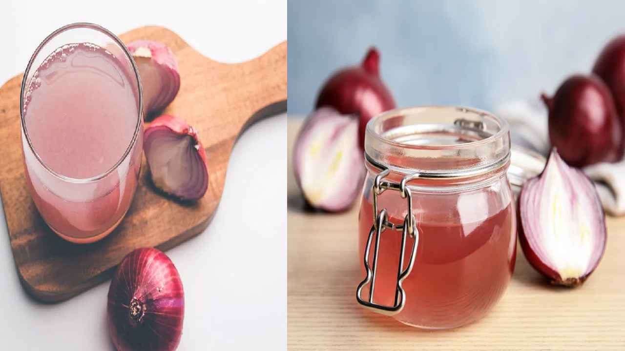 Onion Juice Benefits ಮೂಗೆಳೆಯಬೇಡಿ, ಮೂಗು ಮುಚ್ಚಿಕೊಂಡು ಈರುಳ್ಳಿ ಜ್ಯೂಸ್