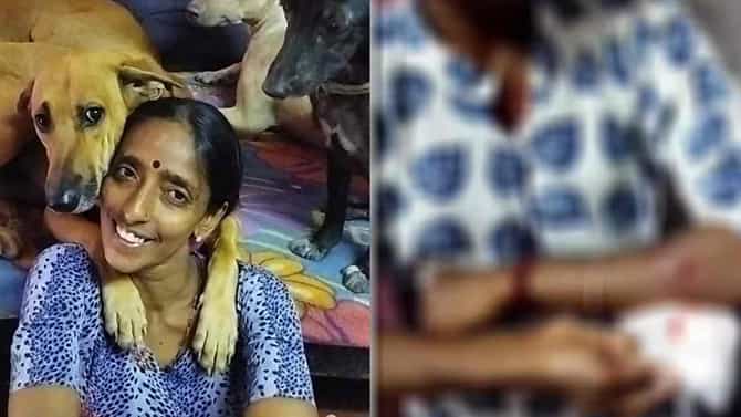 Rajani Shetty: ಶ್ವಾನ ಪ್ರೇಮಿ ರಜನಿ ಶೆಟ್ಟಿಗೆ ಕಲ್ಲಿನಿಂದ ಹೊಡೆದ ನೆರೆಮನೆ ನಿವಾಸಿ: ಕೈಗೆ ಗಾಯ, ದೂರು ದಾಖಲು