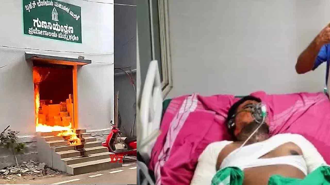 ಬಿಬಿಎಂಪಿ ಅಗ್ನಿ ದುರಂತ ಪ್ರಕರಣ: ಮೂವರ ಸ್ಥಿತಿ ಚಿಂತಾಜನಕ ಬಿಬಿಎಂಪಿ ಅಗ್ನಿ ದುರಂತ ಪ್ರಕರಣ: ಮೂವರ ಸ್ಥಿತಿ ಚಿಂತಾಜನಕ