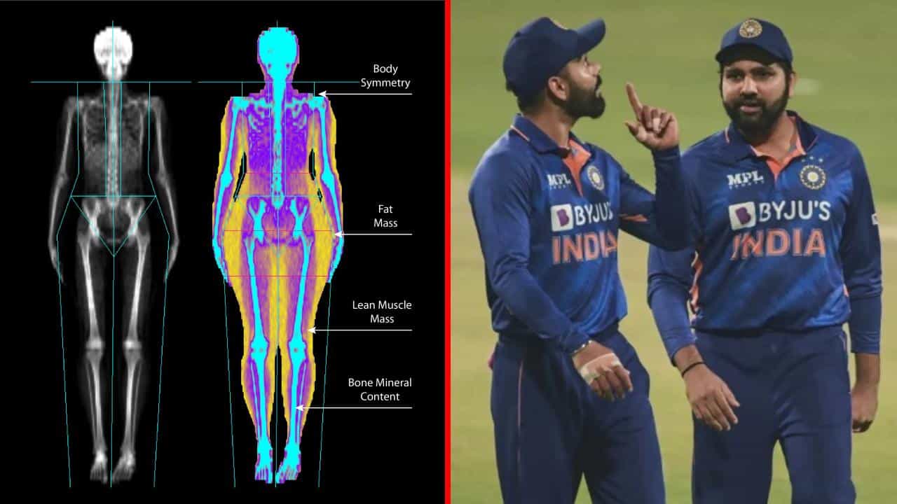 ಏಷ್ಯಾಕಪ್ಗೂ ಮುನ್ನ ಟೀಮ್ ಇಂಡಿಯಾಕ್ಕೆ ವಿಶೇಷ ಸ್ಕ್ಯಾನಿಂಗ್: ಏನಿದು ಡೆಕ್ಸಾ ಸ್ಕ್ಯಾನ್? ಏಷ್ಯಾಕಪ್ಗೂ ಮುನ್ನ ಟೀಮ್ ಇಂಡಿಯಾಕ್ಕೆ ವಿಶೇಷ ಸ್ಕ್ಯಾನಿಂಗ್: ಏನಿದು ಡೆಕ್ಸಾ ಸ್ಕ್ಯಾನ್?