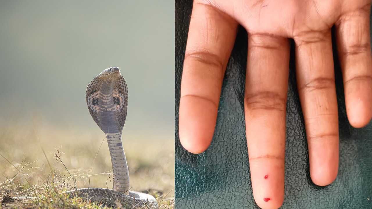 Snake Bite to boy 9 times in two months in Kalaburagi