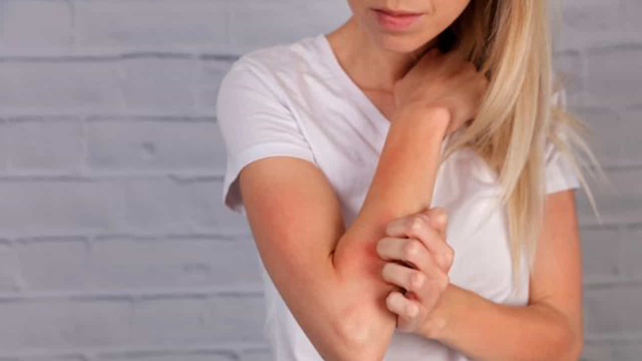 Waxing Allergies Remedies: ವ್ಯಾಕ್ಸಿಂಗ್ ಮಾಡಿದ ನಂತರ ಚರ್ಮದಲ್ಲಿ ತುರಿಕೆ, ದದ್ದುಗಳಂತಹ ಸಮಸ್ಯೆ ಕಾಣಿಸಿಕೊಳ್ಳುತ್ತದೆಯೇ? ಮನೆಮದ್ದು ಇಲ್ಲಿವೆ Waxing Allergies Remedies: ವ್ಯಾಕ್ಸಿಂಗ್ ಮಾಡಿದ ನಂತರ ಚರ್ಮದಲ್ಲಿ ತುರಿಕೆ, ದದ್ದುಗಳಂತಹ ಸಮಸ್ಯೆ ಕಾಣಿಸಿಕೊಳ್ಳುತ್ತದೆಯೇ? ಮನೆಮದ್ದು ಇಲ್ಲಿವೆ