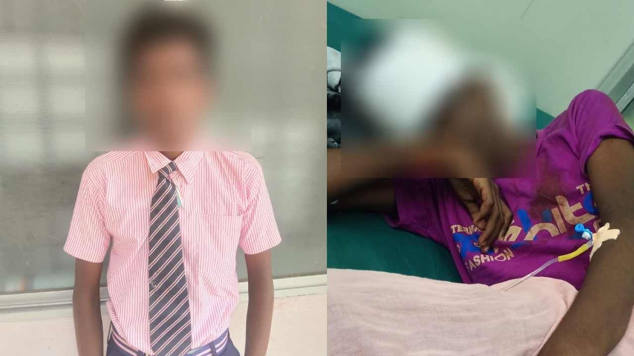 ವಾಲಿಬಾಲ್ ಟಚ್ ಆಯ್ತು ಎಂದು ಜಗಳ; ರಾಡ್ನಿಂದ ವಿದ್ಯಾರ್ಥಿಯಿಂದ ಮತ್ತೊಂದು ವಿದ್ಯಾರ್ಥಿ ಮೇಲೆ ಹಲ್ಲೆ
