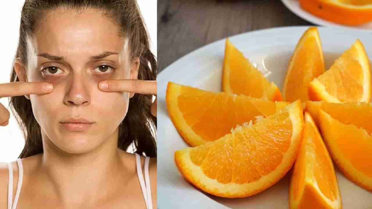 Fruits For Under Eye Dark Circles: ಕಣ್ಣಿನ ಸುತ್ತಲಿನ ಕಪ್ಪು ಕಲೆ ಸಮಸ್ಯೆ ನಿವಾರಿಸಲು ಈ ಹಣ್ಣುಗಳು ಸಹಕಾರಿ