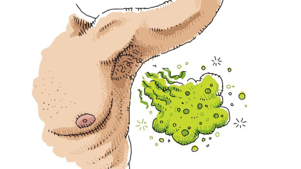 Smelly Armpits: ನಿಮ್ಮ ಈ ಆಹಾರಕ್ರಮಗಳು ಕೂಡ ಕಂಕುಳಲ್ಲಿನ ಕೆಟ್ಟ ವಾಸನೆಗೆ ಕಾರಣವಾಗಬಹುದು!