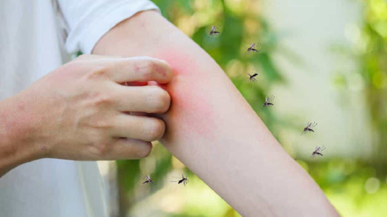 Dengue Hemorrhagic Fever: ಡೆಂಗ್ಯೂ ಹೆಮರಾಜಿಕ್ ಫೀವರ್ ಎಂದರೇನು? ಇದರ 8 ಅಪಾಯಕಾರಿ ಲಕ್ಷಣಗಳಿವು Dengue Hemorrhagic Fever: ಡೆಂಗ್ಯೂ ಹೆಮರಾಜಿಕ್ ಫೀವರ್ ಎಂದರೇನು? ಇದರ 8 ಅಪಾಯಕಾರಿ ಲಕ್ಷಣಗಳಿವು