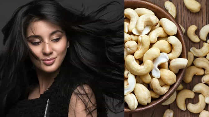ಗೋಡಂಬಿ ತಿನ್ನುತ್ತಿಲ್ಲವೇ? ಅದರ ಆರೋಗ್ಯ ಪ್ರಯೋಜನ ಮಿಸ್​ ಮಾಡಿಕೊಳ್ಳಬೇಡಿ