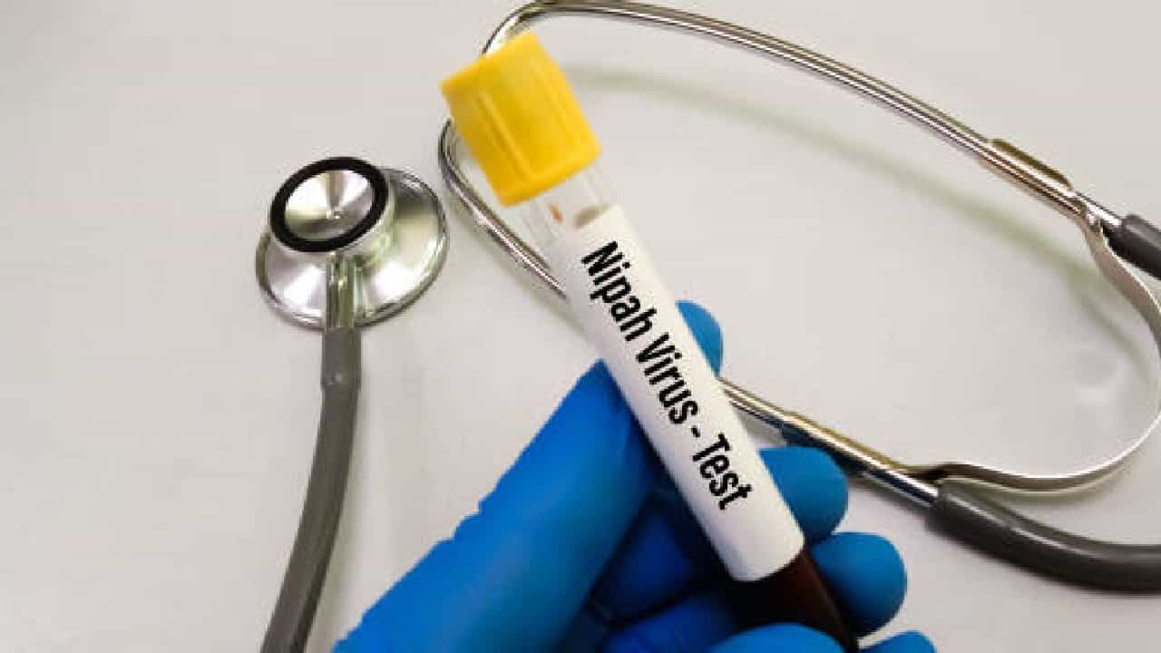 Nipah Virus: ನಿಫಾ ವೈರಸ್ ಮಕ್ಕಳನ್ನೇ ಹೆಚ್ಚು ಕಾಡುವುದೇಕೆ? Nipah Virus: ನಿಫಾ ವೈರಸ್ ಮಕ್ಕಳನ್ನೇ ಹೆಚ್ಚು ಕಾಡುವುದೇಕೆ?