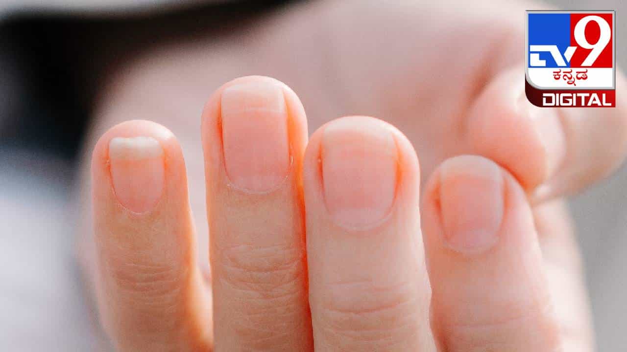 Nail Care: ನೀವು ಉಗುರುಗಳನ್ನು ಆರೋಗ್ಯಕರ ಮತ್ತು ಸುಂದರವಾಗಿರಿಸಲು ಬಯಸಿದರೆ ಈ ಮನೆಮದ್ದುಗಳನ್ನು ಪ್ರಯತ್ನಿಸಿ Nail Care: ನೀವು ಉಗುರುಗಳನ್ನು ಆರೋಗ್ಯಕರ ಮತ್ತು ಸುಂದರವಾಗಿರಿಸಲು ಬಯಸಿದರೆ ಈ ಮನೆಮದ್ದುಗಳನ್ನು ಪ್ರಯತ್ನಿಸಿ