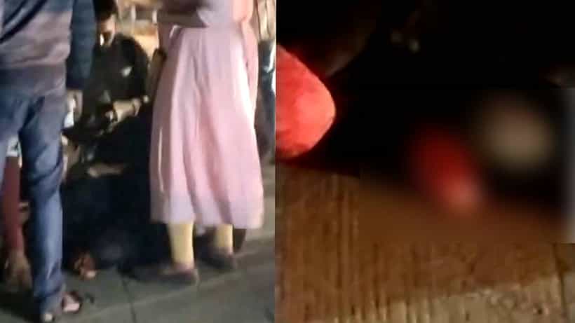 ಬೆಂಗಳೂರು: ಬೈಕ್, ಆಟೋ ಮತ್ತು ಲಾರಿ ಮಧ್ಯೆ ಅಪಘಾತ; ಕಾಲು ಕಳೆದುಕೊಂಡ ಯುವತಿ