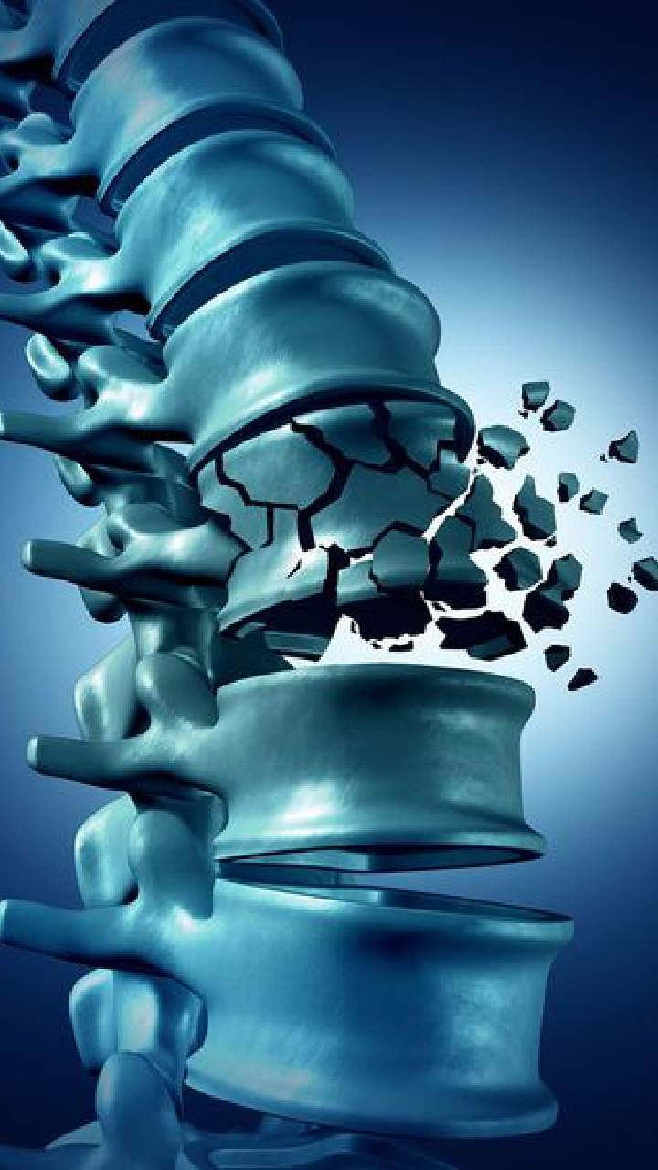 Bone Health (1)