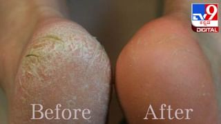 International Day Of Older Persons: ವಿಶ್ವ ಹಿರಿಯರ ದಿನವನ್ನು ಏಕೆ ಆಚರಿಸಲಾಗುತ್ತದೆ? ಅದರ ಇತಿಹಾಸ ಪ್ರಾಮುಖ್ಯತೆ ಇಲ್ಲಿದೆ