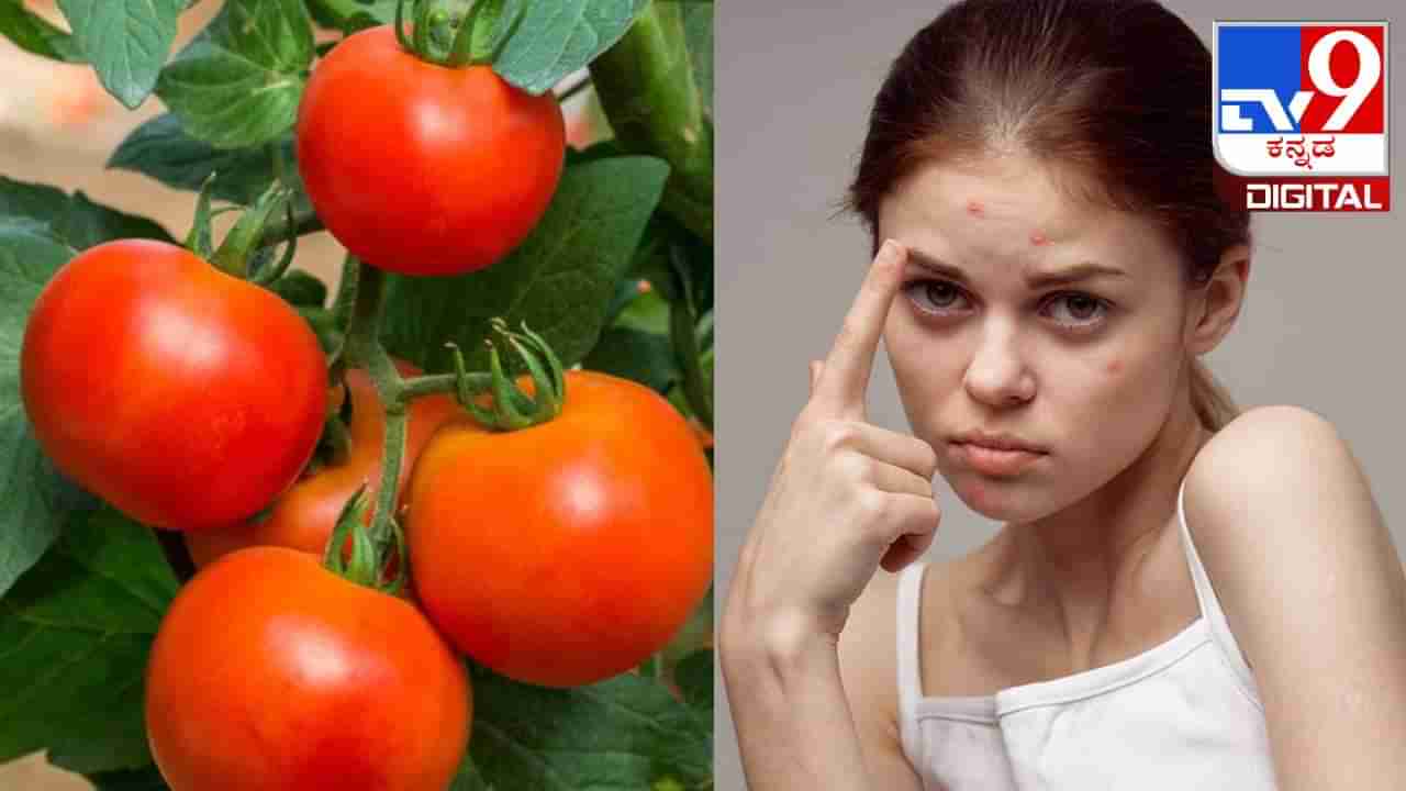 Tomato For Skin: ತ್ವಚೆಯ ಆರೋಗ್ಯಕ್ಕೆ  ಟೊಮೆಟೊ ಎಷ್ಟೆಲ್ಲಾ ಪ್ರಯೋಜನಕಾರಿ ಎಂಬುದನ್ನು ತಿಳಿಯರಿ