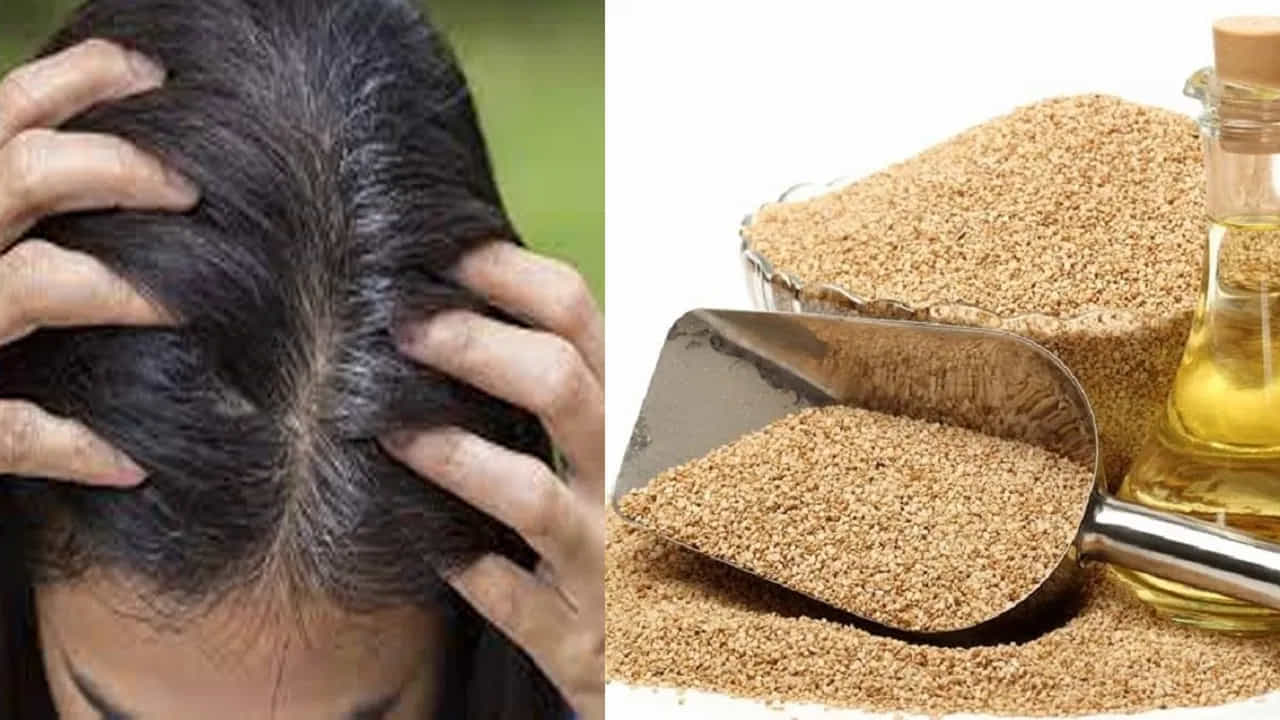 Hair Oil ನಲ್ಲಿ ಇದನ್ನು ಮಿಕ್ಸ್ ಮಾಡಿ ನೈಸರ್ಗಿಕ ಕಪ್ಪು ಕೂದಲನ್ನು ನಿಮ್ಮದಾಗಿಸಿಕೊಳ್ಳಿ! ಬಿಳಿ ಕೂದಲು ಸಮಸ್ಯೆಗೆ ಇದು ದಿವ್ಯ ಔಷಧಿ Hair Oil ನಲ್ಲಿ ಇದನ್ನು ಮಿಕ್ಸ್ ಮಾಡಿ ನೈಸರ್ಗಿಕ ಕಪ್ಪು ಕೂದಲನ್ನು ನಿಮ್ಮದಾಗಿಸಿಕೊಳ್ಳಿ! ಬಿಳಿ ಕೂದಲು ಸಮಸ್ಯೆಗೆ ಇದು ದಿವ್ಯ ಔಷಧಿ