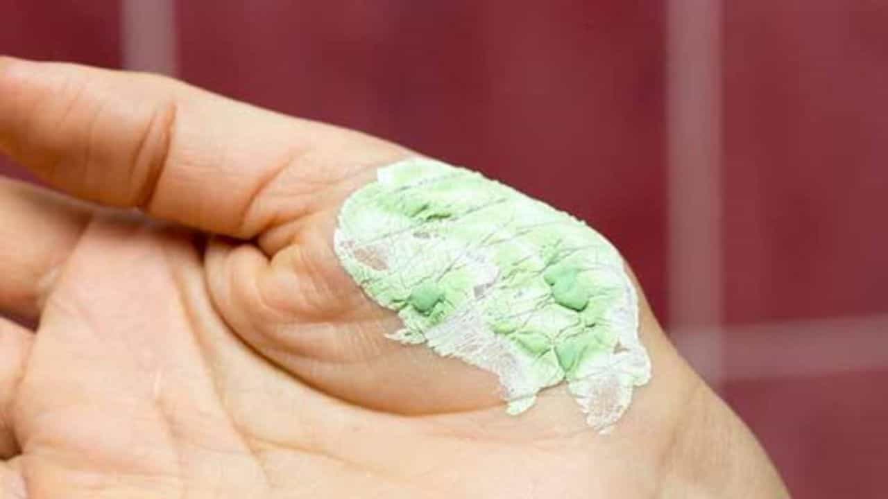 Heal your burns: ಸುಟ್ಟಗಾಯಗಳನ್ನು ಮನೆಯಲ್ಲಿ ನೈಸರ್ಗಿಕವಾಗಿ ಗುಣಪಡಿಸಲು ಇಲ್ಲಿವೆ 6 ಸರಳ ಮಾರ್ಗಗಳು! Heal your burns: ಸುಟ್ಟಗಾಯಗಳನ್ನು ಮನೆಯಲ್ಲಿ ನೈಸರ್ಗಿಕವಾಗಿ ಗುಣಪಡಿಸಲು ಇಲ್ಲಿವೆ 6 ಸರಳ ಮಾರ್ಗಗಳು!