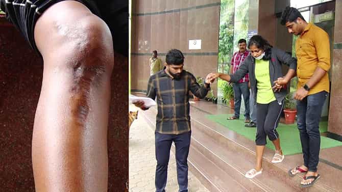 ವೈದ್ಯನ ನಿರ್ಲಕ್ಷ್ಯದಿಂದ ಯುವತಿಯ ಸೇನೆ ಸೇರುವ ಕನಸು ನುಚ್ಚುನೂರು