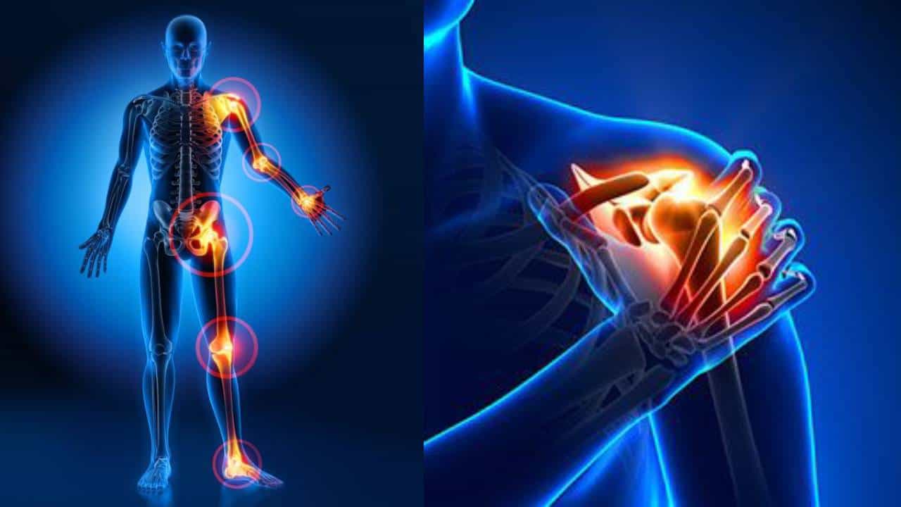 World Arthritis day 2023: ಯುವಕರೇ ಹೆಚ್ಚು ಸಂಧಿವಾತಕ್ಕೆ ಬಲಿಯಾಗುತ್ತಿದ್ದಾರೆ: ಡಾ. ಅಮಿತ್ ಪಂಕಜ್ ಅಗರ್ವಾಲ್ World Arthritis day 2023: ಯುವಕರೇ ಹೆಚ್ಚು ಸಂಧಿವಾತಕ್ಕೆ ಬಲಿಯಾಗುತ್ತಿದ್ದಾರೆ: ಡಾ. ಅಮಿತ್ ಪಂಕಜ್ ಅಗರ್ವಾಲ್