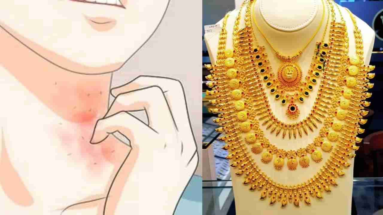 Artificial Jewelry: ಕೃತಕ ಆಭರಣಗಳು ಚರ್ಮದ ಅಲರ್ಜಿಯನ್ನು ಉಂಟುಮಾಡಬಹುದು