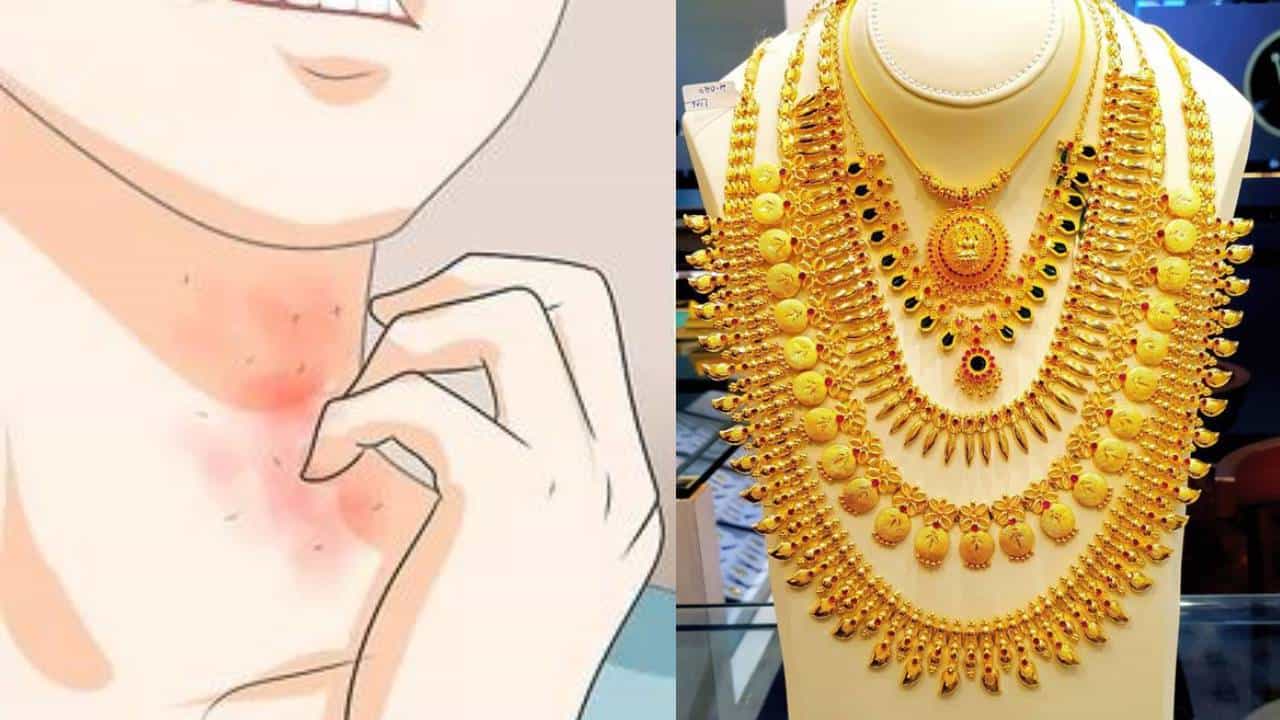 Artificial Jewelry: ಕೃತಕ ಆಭರಣಗಳು ಚರ್ಮದ ಅಲರ್ಜಿಯನ್ನು ಉಂಟುಮಾಡಬಹುದು Artificial Jewelry: ಕೃತಕ ಆಭರಣಗಳು ಚರ್ಮದ ಅಲರ್ಜಿಯನ್ನು ಉಂಟುಮಾಡಬಹುದು