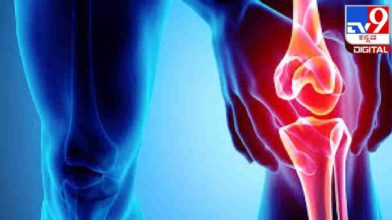 Knee Pain: ನೀವು ಮೊಣಕಾಲು ನೋವಿನಿಂದ ಬಳಲುತ್ತಿದ್ದರೆ, ಈ ಆಹಾರಗಳ ಸೇವನೆ ತಪ್ಪಿಸಿ