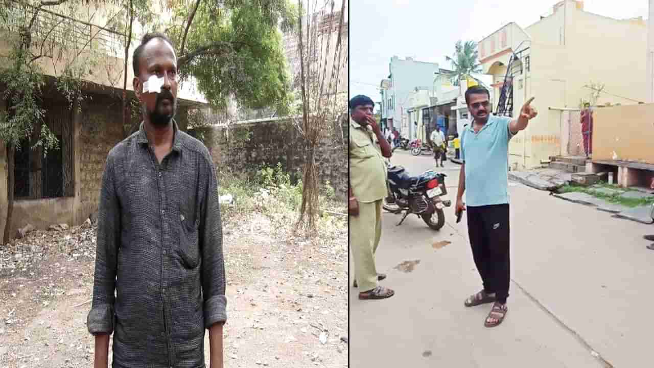 ಕುಡುತಿನಿ ಪಟ್ಟಣ ಪಂಚಾಯತಿ ಮುಖ್ಯಾಧಿಕಾರಿ ಗೂಂಡಾವರ್ತನೆ;ಮೂಲಭೂತ ಸೌಕರ್ಯ ಕೇಳಿದಕ್ಕೆ ವ್ಯಕ್ತಿ ಮೇಲೆ ಹಲ್ಲೆ