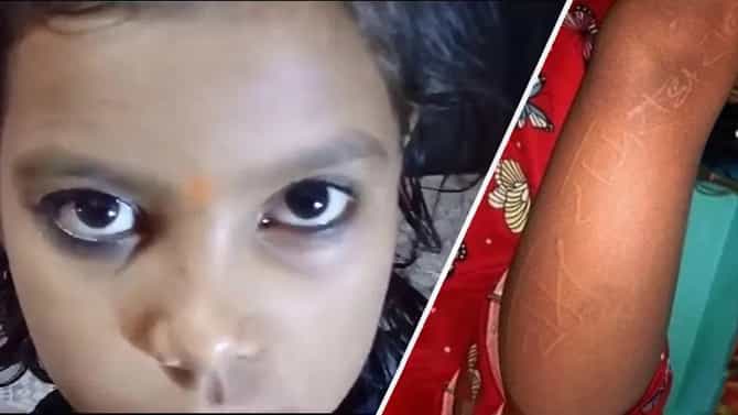 ಪುಟ್ಟ ಬಾಲಕಿಯ ಮೈಮೇಲೆ ರಾಮ್ ಮತ್ತು ರಾಧಾ ಹೆಸರುಗಳು