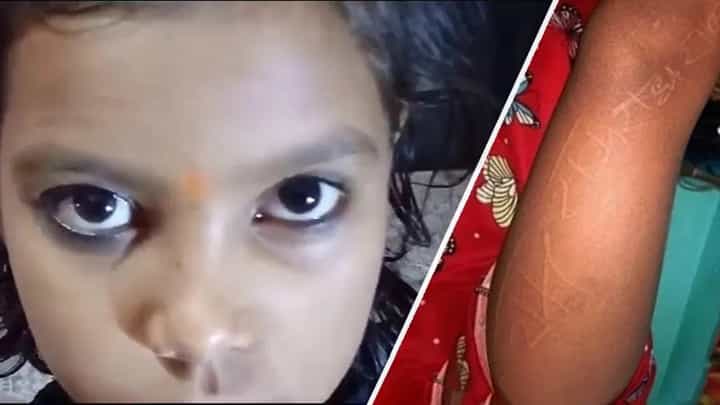 Viral Video: ಪುಟ್ಟ ಬಾಲಕಿಯ ಮೈಮೇಲೆ ರಾಮ್ ಮತ್ತು ರಾಧಾ ಹೆಸರುಗಳು! ವೈದ್ಯರಿಗೆ ಶಾಕ್, ಎಲ್ಲಾ ದೇವರ ದಯೆ ಎನ್ನುತ್ತಿದ್ದಾರೆ ಜನ Viral Video: ಪುಟ್ಟ ಬಾಲಕಿಯ ಮೈಮೇಲೆ ರಾಮ್ ಮತ್ತು ರಾಧಾ ಹೆಸರುಗಳು! ವೈದ್ಯರಿಗೆ ಶಾಕ್, ಎಲ್ಲಾ ದೇವರ ದಯೆ ಎನ್ನುತ್ತಿದ್ದಾರೆ ಜನ