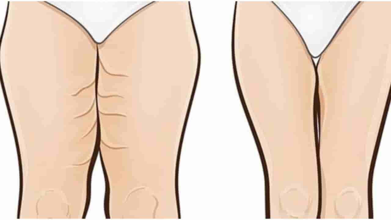 ತೊಡೆಯ ಕೊಬ್ಬನ್ನು ಕಡಿಮೆ ಮಾಡಲು ಈ 5 ಯೋಗ ಭಂಗಿಗಳು ಉತ್ತಮ