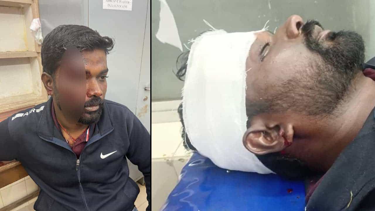 ಶಿವಮೊಗ್ಗದಲ್ಲಿ ಬಿಜೆಪಿ ಮುಖಂಡನ ಮೇಲೆ ಹಲ್ಲೆ: ಭದ್ರಾವತಿ ಶಾಸಕರ ವಿರುದ್ಧ ಪೋಸ್ಟ್ ಹಾಕಿದ್ದಕ್ಕೆ ಹಲ್ಲೆ ಆರೋಪ ಶಿವಮೊಗ್ಗದಲ್ಲಿ ಬಿಜೆಪಿ ಮುಖಂಡನ ಮೇಲೆ ಹಲ್ಲೆ: ಭದ್ರಾವತಿ ಶಾಸಕರ ವಿರುದ್ಧ ಪೋಸ್ಟ್ ಹಾಕಿದ್ದಕ್ಕೆ ಹಲ್ಲೆ ಆರೋಪ