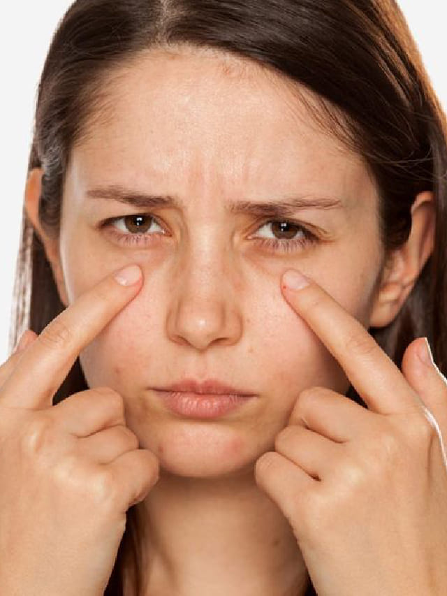 ಡಾರ್ಕ್ ಸರ್ಕಲ್ ನಿವಾರಣೆಗೆ ತೆಂಗಿನ ನೀರು ಉತ್ತಮ ಮನೆಮದ್ದು Kannada News Benefits of coconut water