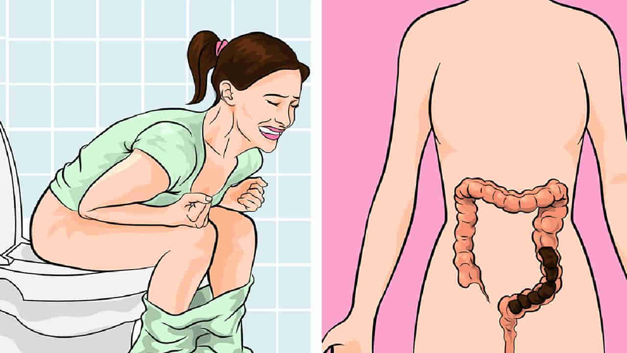 Constipation: ನಿಮ್ಮ ದಿನನಿತ್ಯದ ಈ ಅಭ್ಯಾಸಗಳು ಹೊಟ್ಟೆ ಉಬ್ಬರಕ್ಕೆ ಕಾರಣವಾಗುತ್ತವೆ