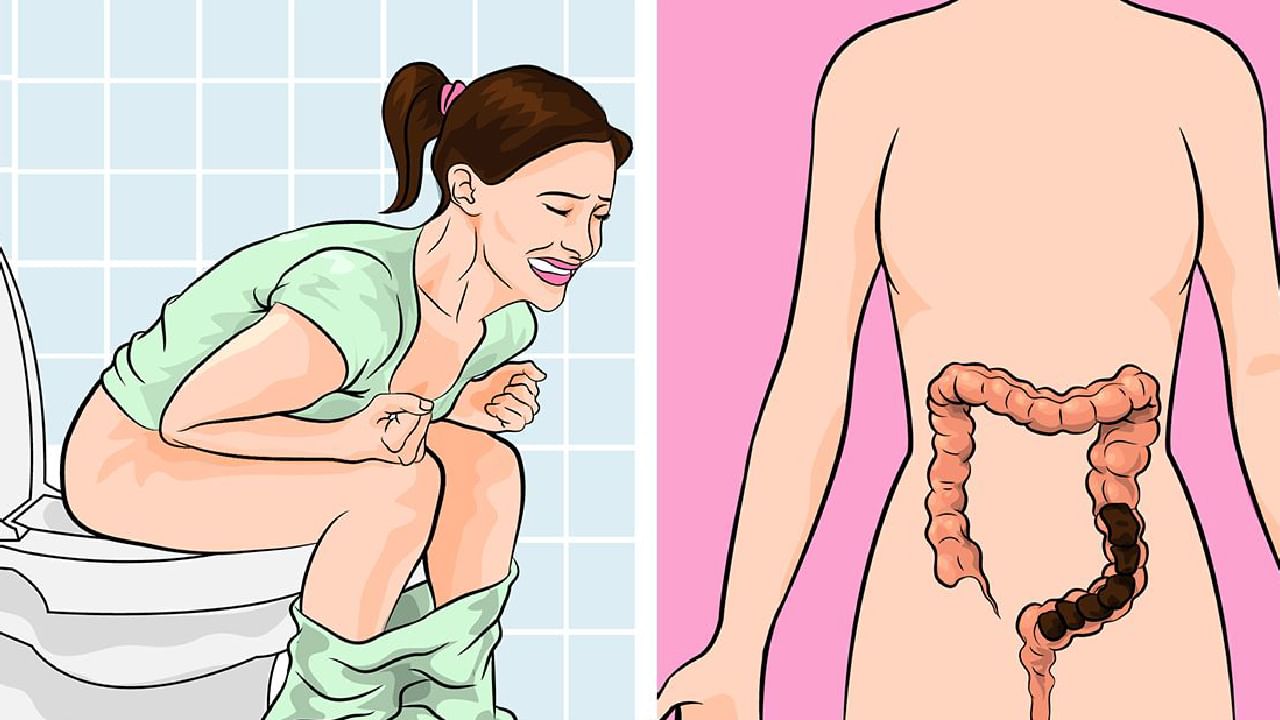 Constipation: ನಿಮ್ಮ ದಿನನಿತ್ಯದ ಈ ಅಭ್ಯಾಸಗಳು ಹೊಟ್ಟೆ ಉಬ್ಬರಕ್ಕೆ ಕಾರಣವಾಗುತ್ತವೆ