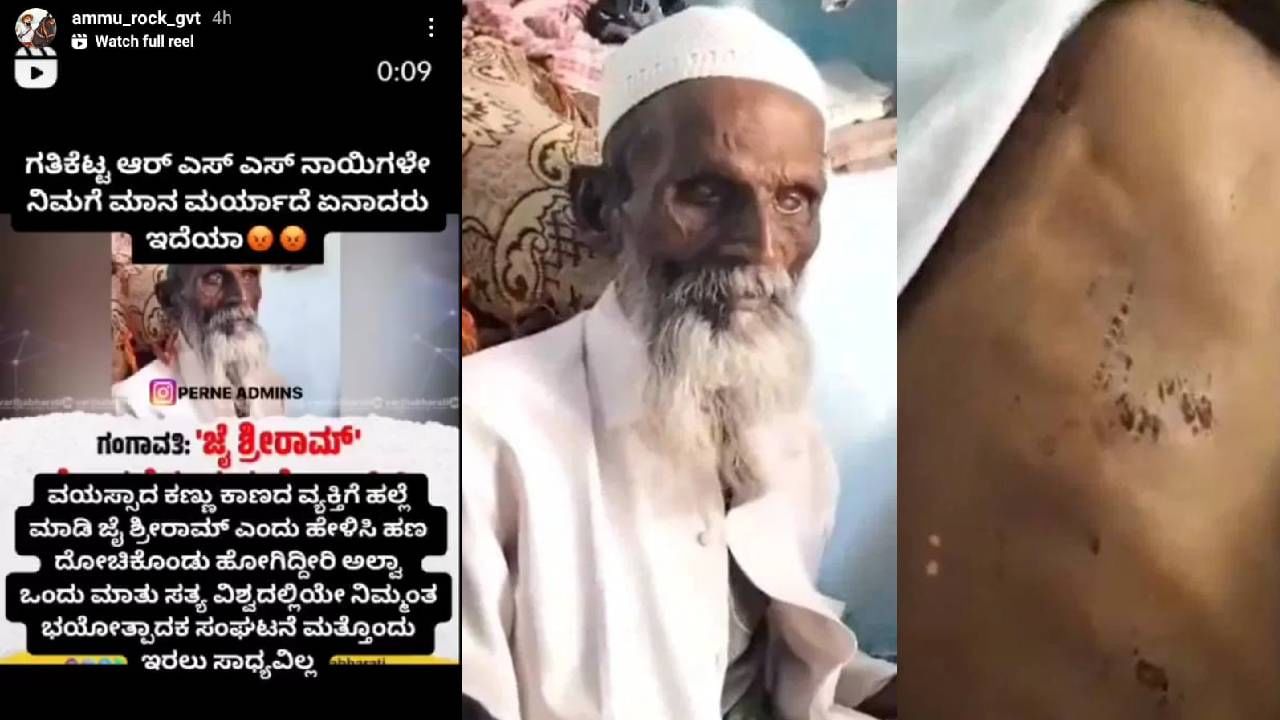 ಜೈ ಶ್ರೀರಾಮ್ ಹೇಳುವಂತೆ ವೈದ್ಧನ ಮೇಲೆ ಹಲ್ಲೆ ಕೇಸ್; ಆಕ್ಷೇಪಾರ್ಹ ಪೋಸ್ಟ್ ಹಾಕಿದವನ ವಿರುದ್ಧ ಪ್ರಕರಣ ದಾಖಲು ಜೈ ಶ್ರೀರಾಮ್ ಹೇಳುವಂತೆ ವೈದ್ಧನ ಮೇಲೆ ಹಲ್ಲೆ ಕೇಸ್; ಆಕ್ಷೇಪಾರ್ಹ ಪೋಸ್ಟ್ ಹಾಕಿದವನ ವಿರುದ್ಧ ಪ್ರಕರಣ ದಾಖಲು