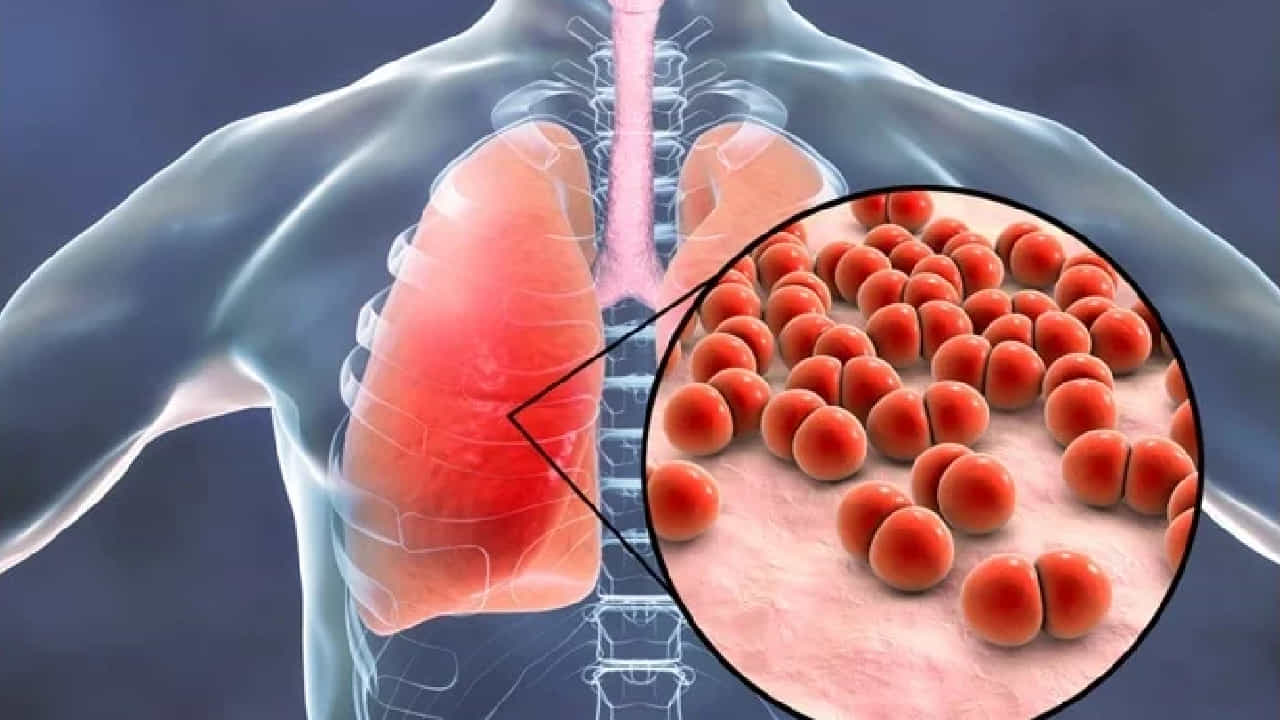 Pneumonia: ಚಳಿಗಾಲದಲ್ಲಿ ನ್ಯುಮೋನಿಯಾಗೆ ಬಲಿಯಾಗಬೇಡಿ, ಈ ಲಕ್ಷಣ ಕಂಡು ಬಂದರೆ ವೈದ್ಯರನ್ನು ಭೇಟಿಯಾಗಿ Pneumonia: ಚಳಿಗಾಲದಲ್ಲಿ ನ್ಯುಮೋನಿಯಾಗೆ ಬಲಿಯಾಗಬೇಡಿ, ಈ ಲಕ್ಷಣ ಕಂಡು ಬಂದರೆ ವೈದ್ಯರನ್ನು ಭೇಟಿಯಾಗಿ