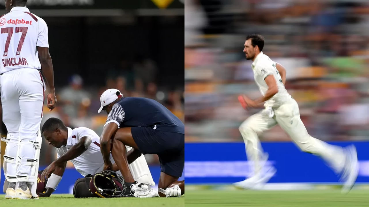 AUS vs WI: ವಿಂಡೀಸ್ ಆಟಗಾರನ ಕಾಲ್ಬೆರಳನ್ನು ಮುರಿದ ಸ್ಟಾರ್ಕ್​ ಎಸೆದ ಬೆಂಕಿ ಚೆಂಡು! ವಿಡಿಯೋ ನೋಡಿ