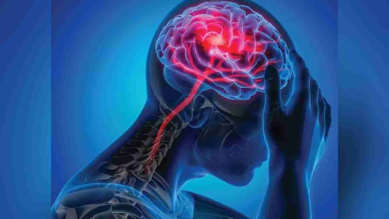 Brain Stroke: ಚಳಿಗಾಲದಲ್ಲಿ ಹೃದಯಾಘಾತವಷ್ಟೇ ಅಲ್ಲ ಮೆದುಳಿನ ಕಾಯಿಲೆಗೂ ಬಲಿಯಾಗುವ ಅಪಾಯ ಹೆಚ್ಚಿದೆ!