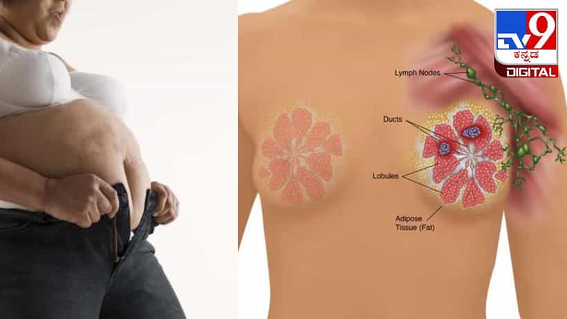Breast cancer: ಸ್ಥೂಲಕಾಯತೆಯು ಸ್ತನ ಕ್ಯಾನ್ಸರ್ಗೆ ಕಾರಣವಾಗಬಹುದು!