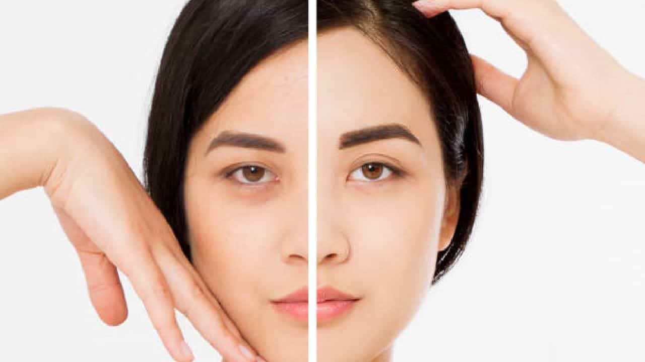 ಕಣ್ಣಿನ ಕೆಳಗೆ ಮೂಡುವ ಕಪ್ಪು ವರ್ತುಲ ಅಥವಾ ಡಾರ್ಕ್ ಸರ್ಕಲ್ ನಮ್ಮ ಮುಖದ ಸೌಂದರ್ಯವನ್ನೇ ಹಾಳು ಮಾಡುತ್ತದೆ.